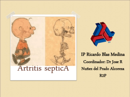 Artritis Séptica