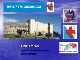 Arritmias - CardioAtrio