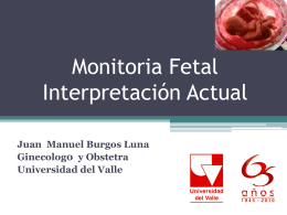Monitoria Fetal general