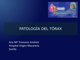 Patología toracica en radiologia convencional Ter. Ana María