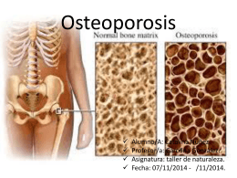 osteoporosis Catalina Nunez final 141KB Nov 21 2014 09:53