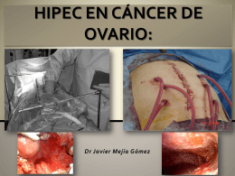 hipec en cáncer de ovario