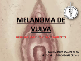 melanoma de vulva – generalidades y tratamiento