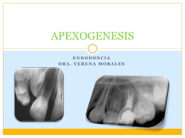 APEXOGENESIS - 3 Odontologia Ceus