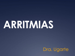 ARRITMIAS - MOP-UNAB