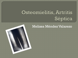 osteomielitis, artritis septica