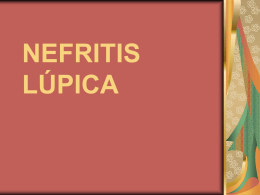 NEFRITIS LÚPICA - Seccionseis’s Weblog