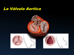 La válvula Aortica - Curso de ecografía en UCI