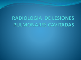 RADIOLOGIA DE LESIONES PULMONARES CAVITADAS