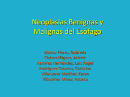Neoplasias Benignas y Malignas del Esófago