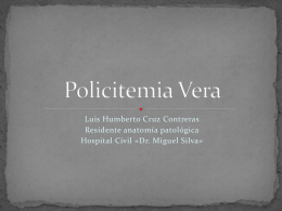 Policitemia Vera