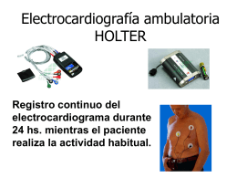 Electrocardiografía ambulatoria HOLTER