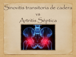 Sinovitis transitoria de cadera vs Artritis