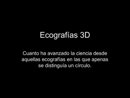 Ecografías 3D