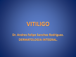 VITILIGO - Dr. Andres Sanchez