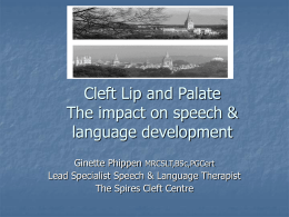 Cleft Lip and Palate The impact on speech &