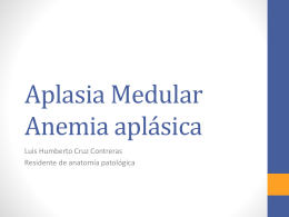 Aplasia Medula Anemia aplásica