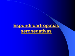 Espondiloartropatías seronegativas
