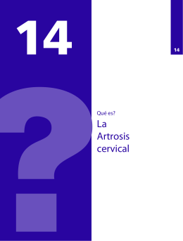 Artrosis Cervical