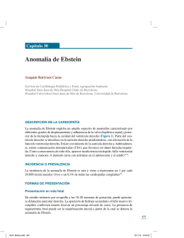 Anomalía de Ebstein - Sociedad Española de Cardiología