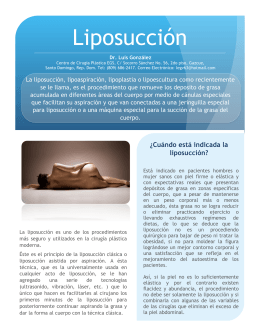 Liposucción - Ciruplastic