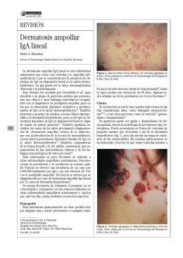 Dermatosis ampollar IgA lineal
