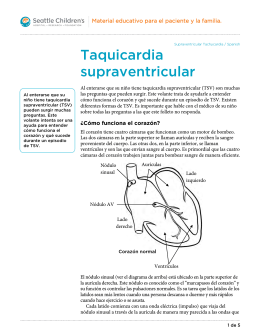 PE888S Supraventricular Tachycardia - Spanish