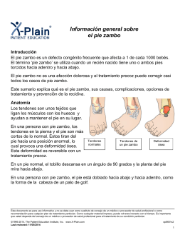 Clubfoot Overview (Spanish) - Patient Education Institute