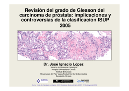 Revisión del grado de Gleason del carcinoma de próstata