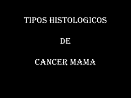 TIPOS HISTOLOGICOS DEL CANCER MAMA