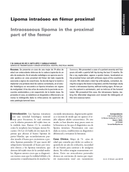 Lipoma intraóseo en fémur proximal Intraosseous lipoma in the