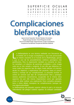 Complicaciones blefaroplastia