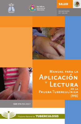 Manual para la Aplicación y Lectura de la Prueba Tuberculínica (PPD)