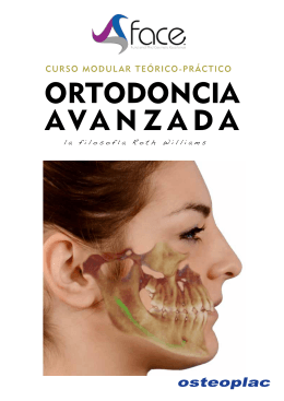 ortodoncia avanzada - Clínica de Ortodoncia MARTÍN GOENAGA