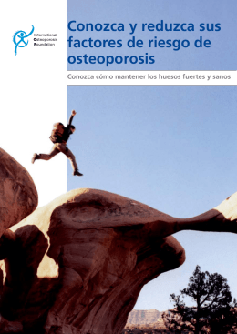 Conozca y reduzca sus factores de riesgo de osteoporosis
