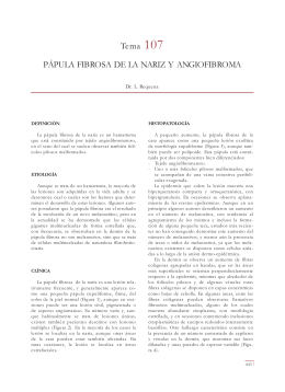 Tema 107 PÁPULA FIBROSA DE LA NARIZ Y ANGIOFIBROMA