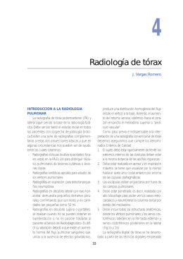 Radiología de tórax