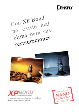 Folleto XP Bond