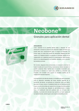 Neobone® - ElServer.com
