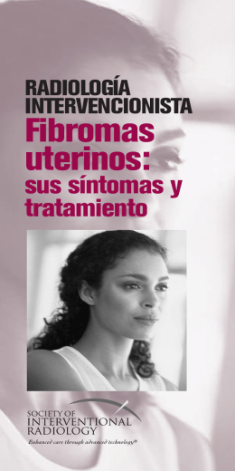 Fibromas uterinos: - Society Of Interventional Radiology