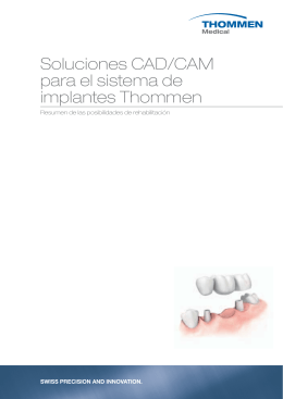 Soluciones CAD/CAM para el sistema de implantes Thommen