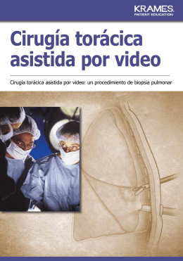 Cirugía torácica asistida por video
