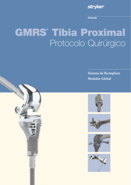 GMRS® Tibia Proximal