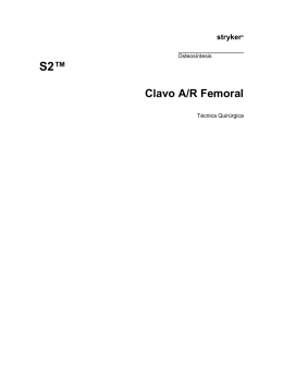 Clavo A-R Femoral - TECNICA QUIRURGICA