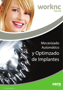 WorkNC Dental / Implantes