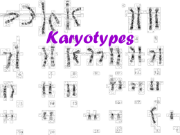 Karyotype - U