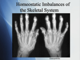 Homeostatic Imbalances of Bones