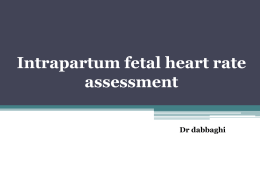 Intrapartum fetal heart rate assessment