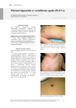 Pitiriasis liquenoide et varioliforme aguda (PLEVA)