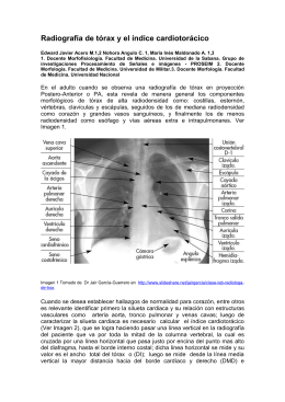 Radiografía de tórax y el índice cardiotorácico